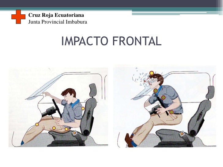 cinematica del trauma